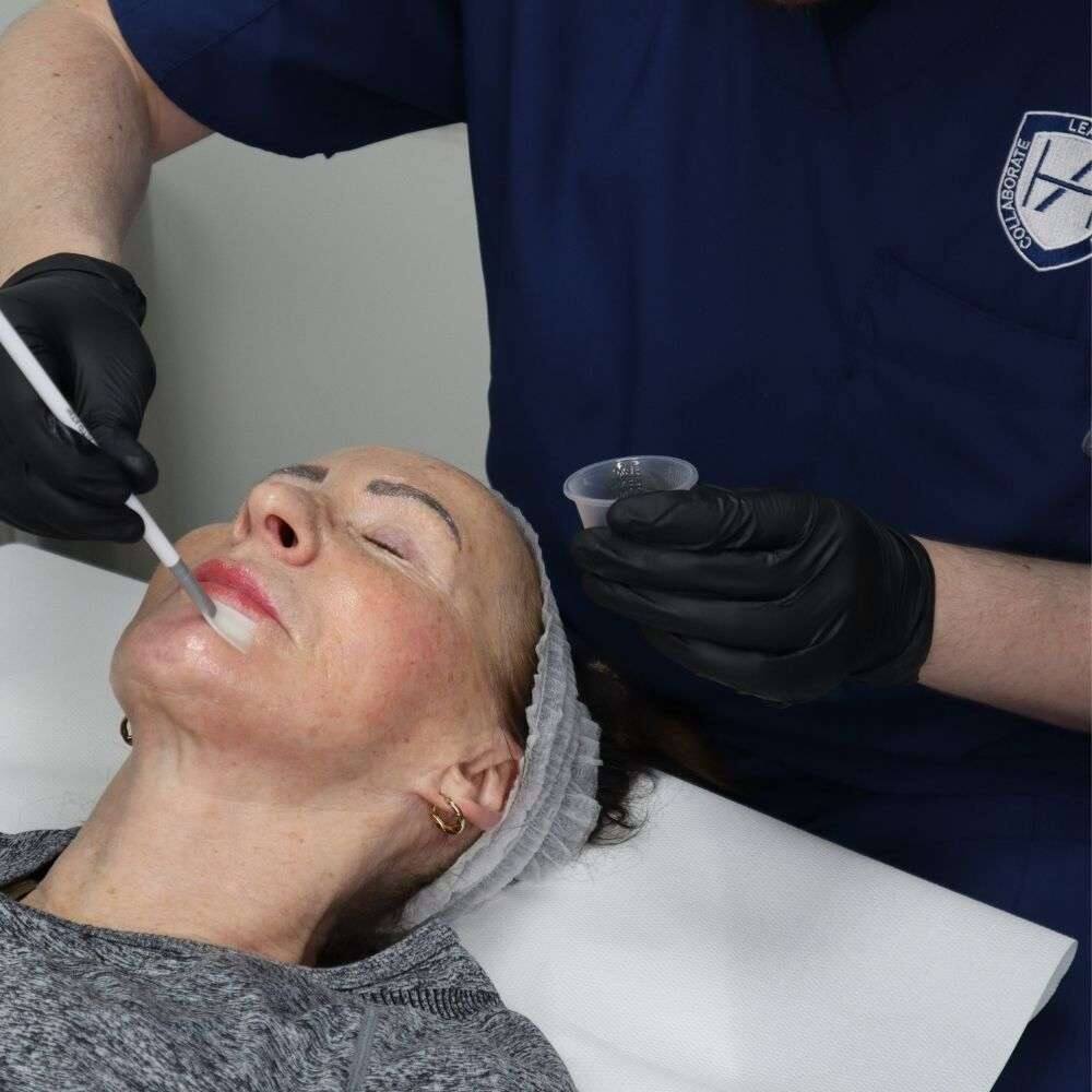 Chemical peel packages